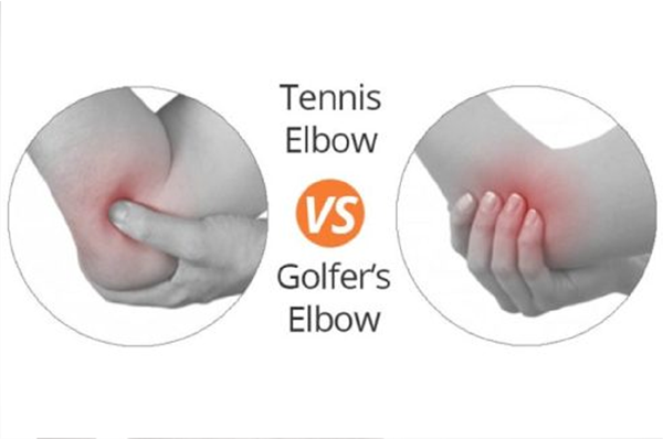 Tennis and Golfer Elbow