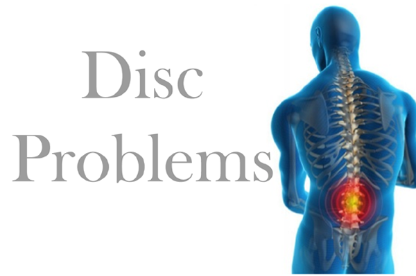 DISC Related Problems