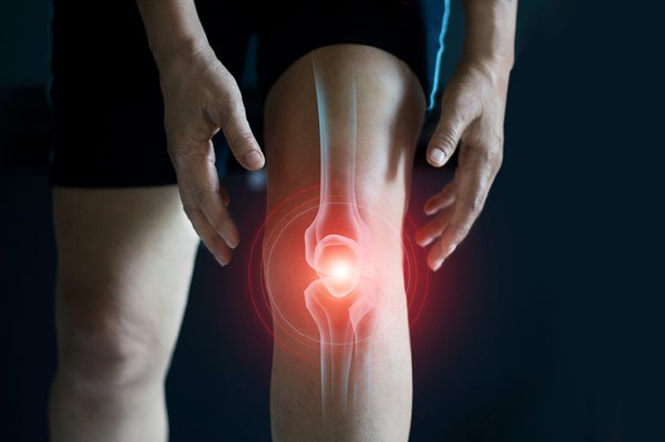Arthritis and Knee Pain